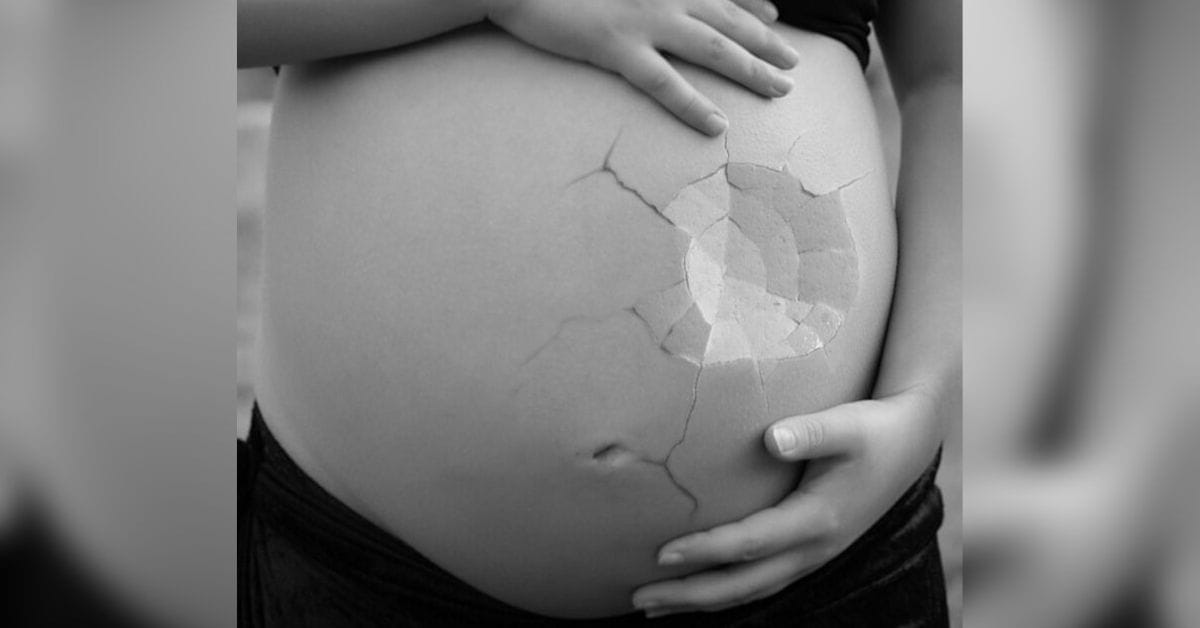 Le Practican Un Aborto Por Error A Una Paciente Embarazada 4608