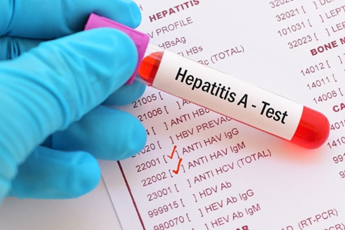 Día Mundial contra la Hepatitis | Foto: Cortesía.